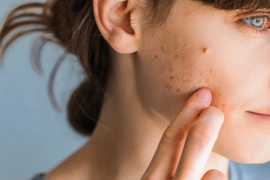 L'utilizzo dell'Olio di CBD nella Skincare quotidiana: Il Consiglio dalla Cosmetologa